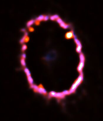 SN1987A